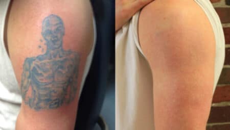 How to Make Your Tattoo Stand Out with Contrast