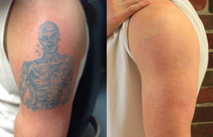 How to Make Your Tattoo Stand Out with Contrast